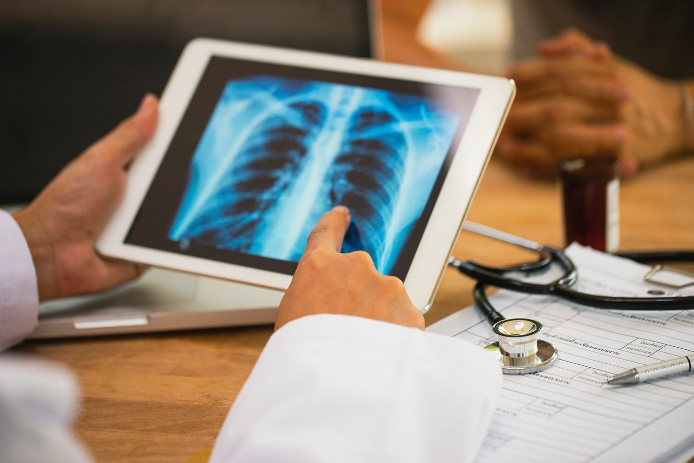 Salute delle ossa, le quattro mosse consigliate da un medico per proteggerle con l'età